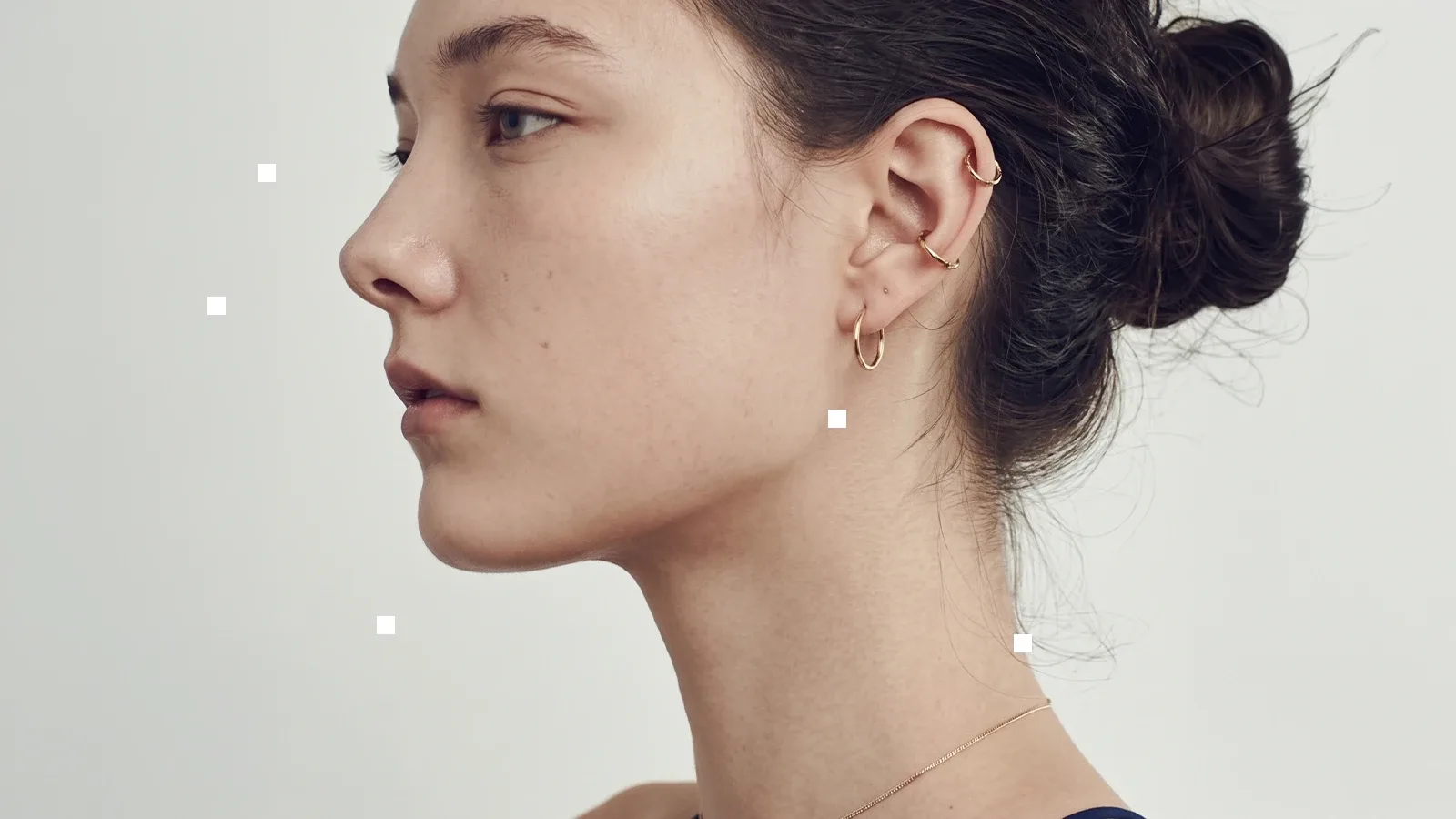 Mentón retraído: por qué cambia todo tu perfil (y por qué crees que es tu nariz)