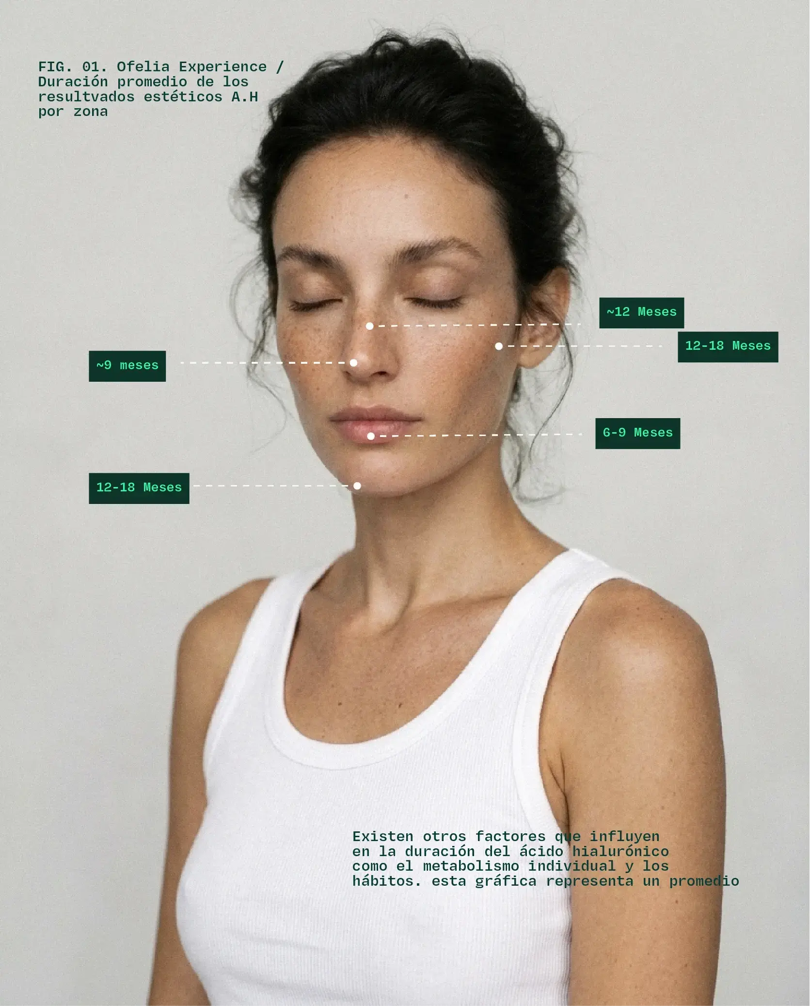 Infografía de duración del ácido hialurónico por zona facial: labios, punta nasal, dorso nasal, pómulos y mentón