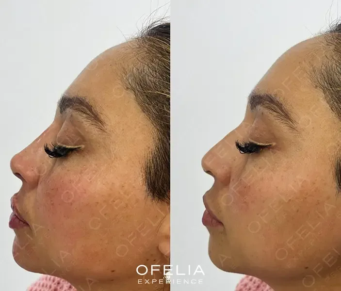 Descripción de la imagen 1