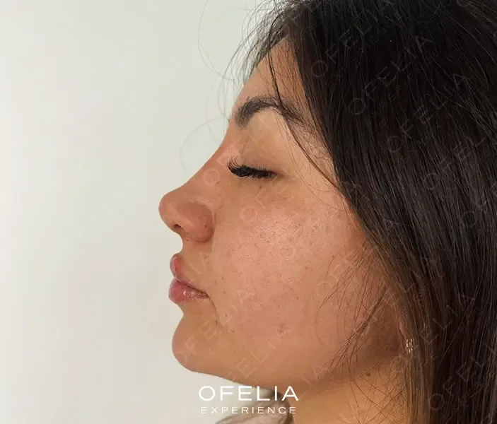 Descripción de la imagen 1