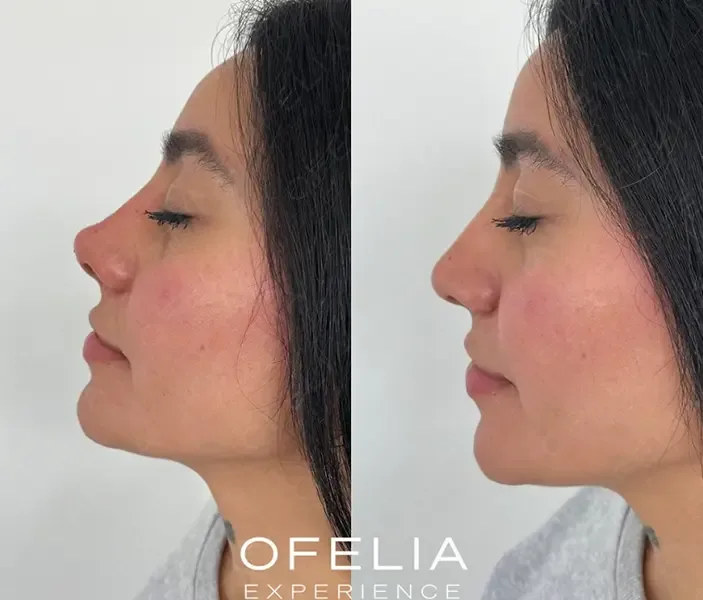 Descripción de la imagen 1