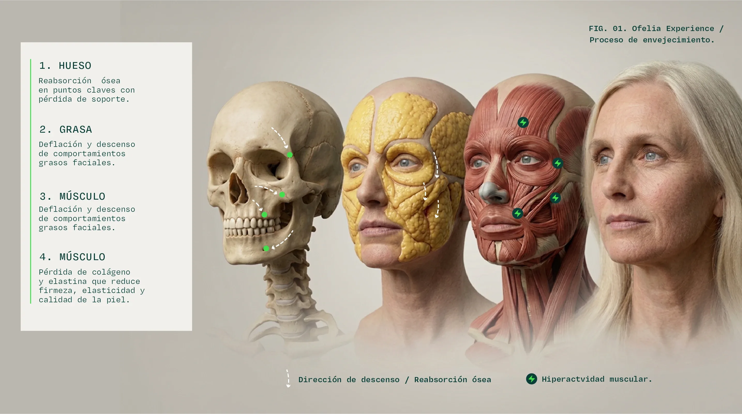 Diagrama de los 4 pilares del envejecimiento facial: hueso con reabsorción ósea, grasa con deflación de compartimentos, músculo hiperactivo y piel con pérdida de colágeno